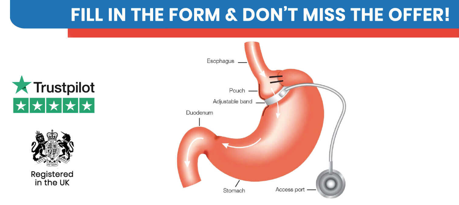 Adjustable Gastric Banding in Turkey