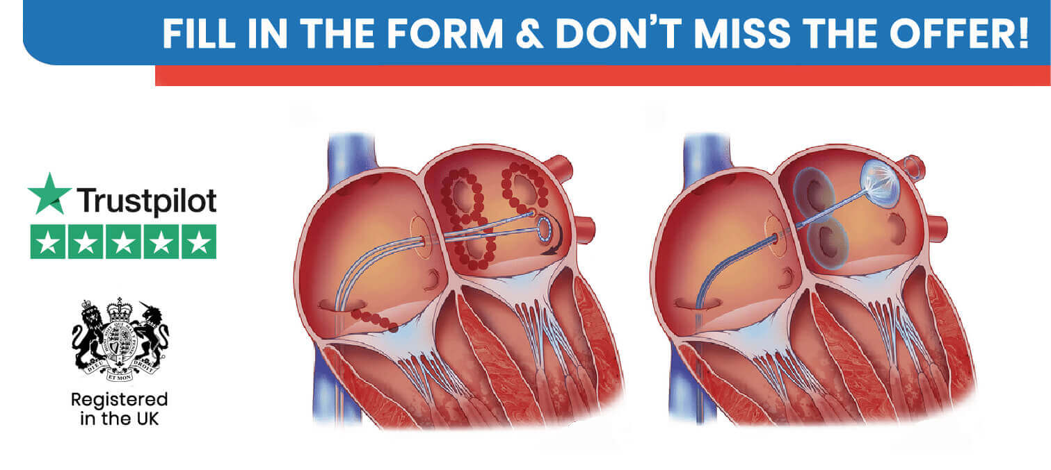 Catheter Ablation in Turkey