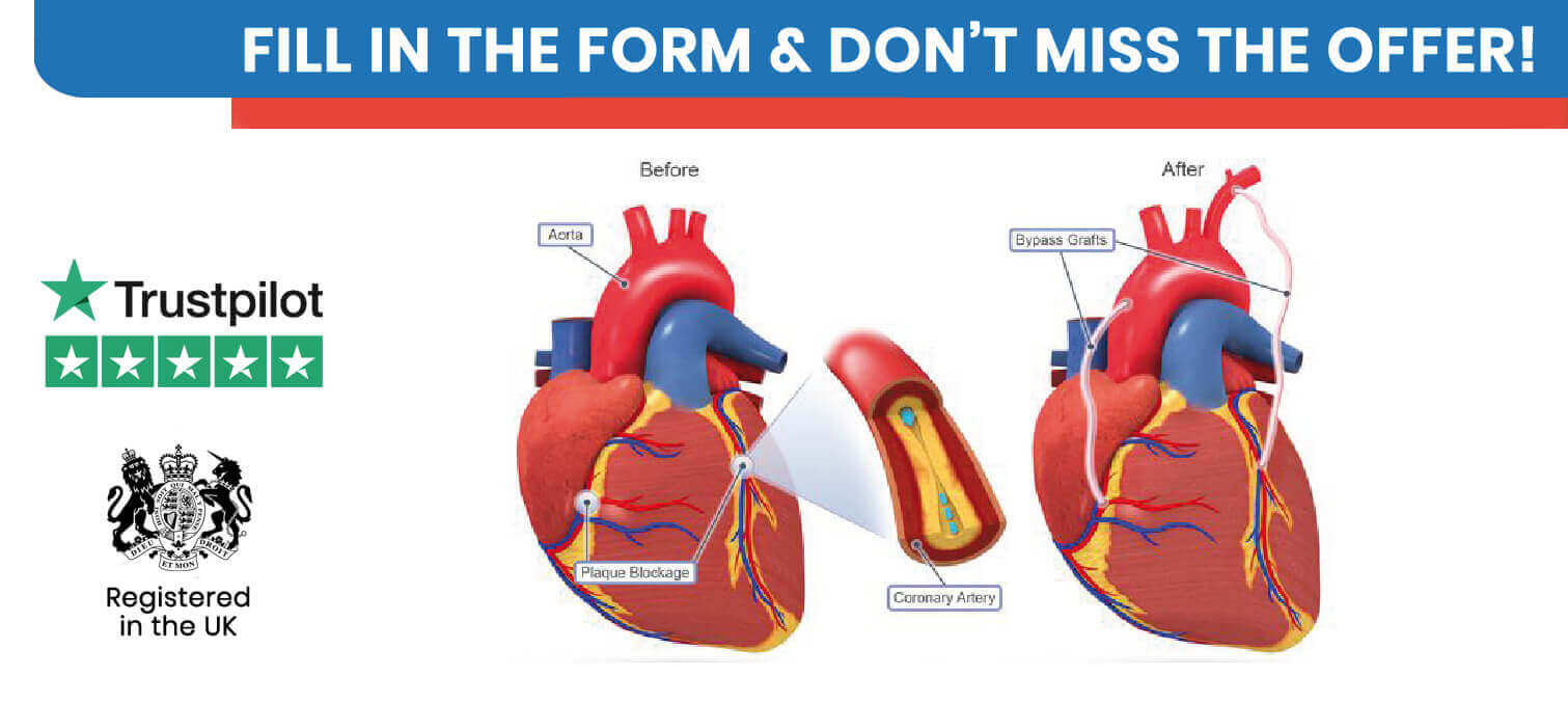 Coronary Bypass in Turkey