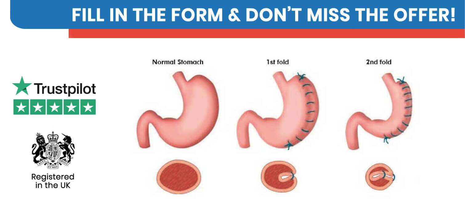 Gastric Plication in Turkey