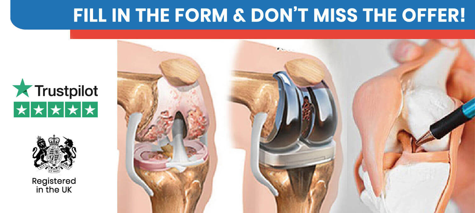 Knee Replacement in Turkey