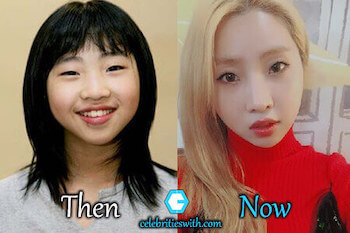 K-Pop Idols That Have Had Plastic Surgery | Blog | Clinic Center