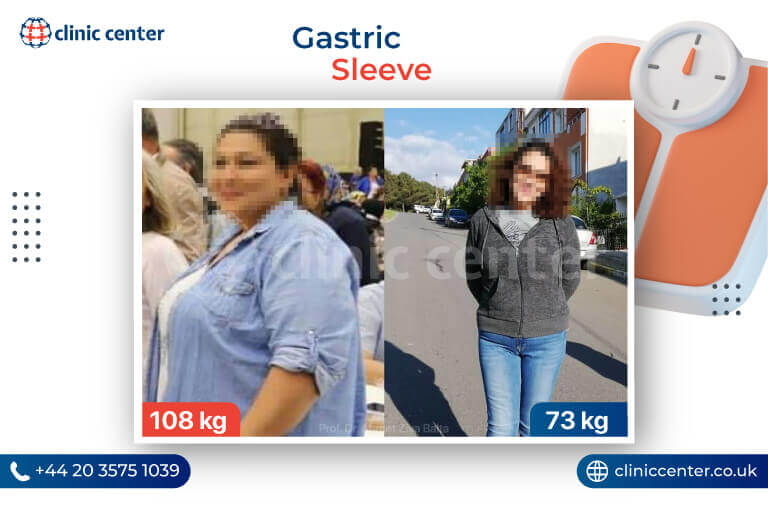 Gastric Sleeve Surgery & Cost In Turkey Clinic Center