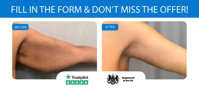 Armpit fat before and after Brachioplasty, liposuction or plastic