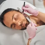 Beard Transplant
