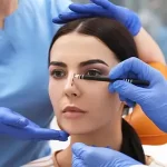 Rhinoplasty
